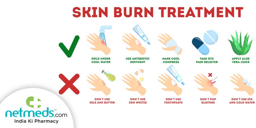 how to treat burns